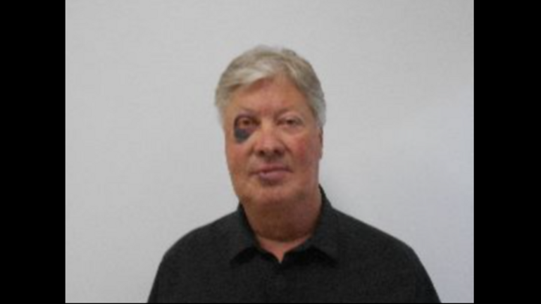 Former Gateway pastor suffers black eye, broken facial bones in medical incident