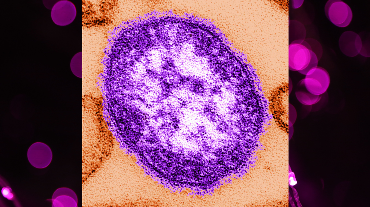 The measles virus is one of the most contagious pathogens.