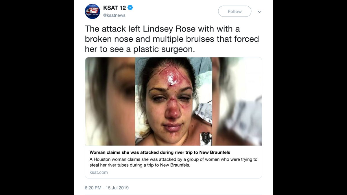Lindsey Rose had to see a plastic surgeon after she said she was attacked after tubing a river in New Braunfels, Texas.