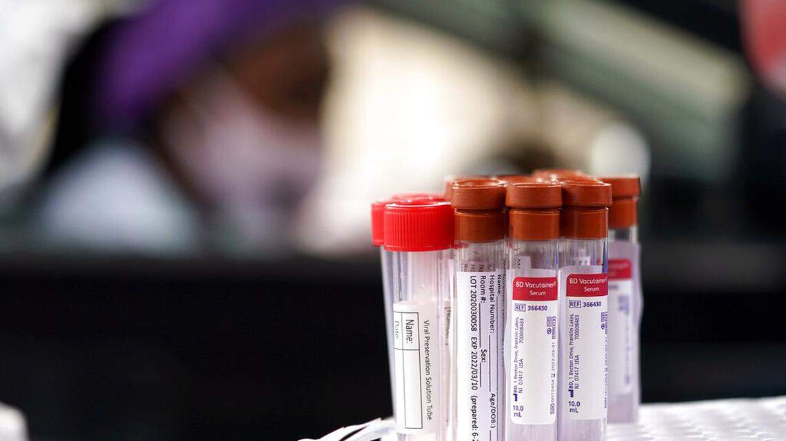 Five workers at a 911 center tested positive for COVID-19, North Carolina officials say.