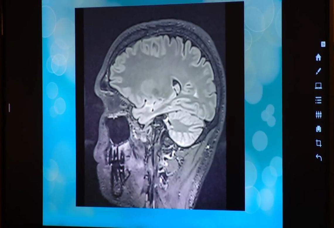 A scan of Tanner Horner’s brain was shown in court on Friday, April 24.