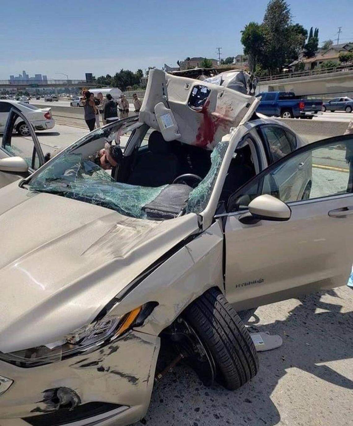 An 18-wheeler tire flew through Evan Folan’s windshield on July 23, 2019 in Los Angeles, causing a traumatic brain injury that he lives with every day.