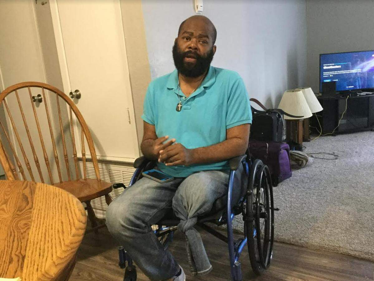 Prince Starr had to have two amputations on his left leg, but he says he meets the challenge head-on.