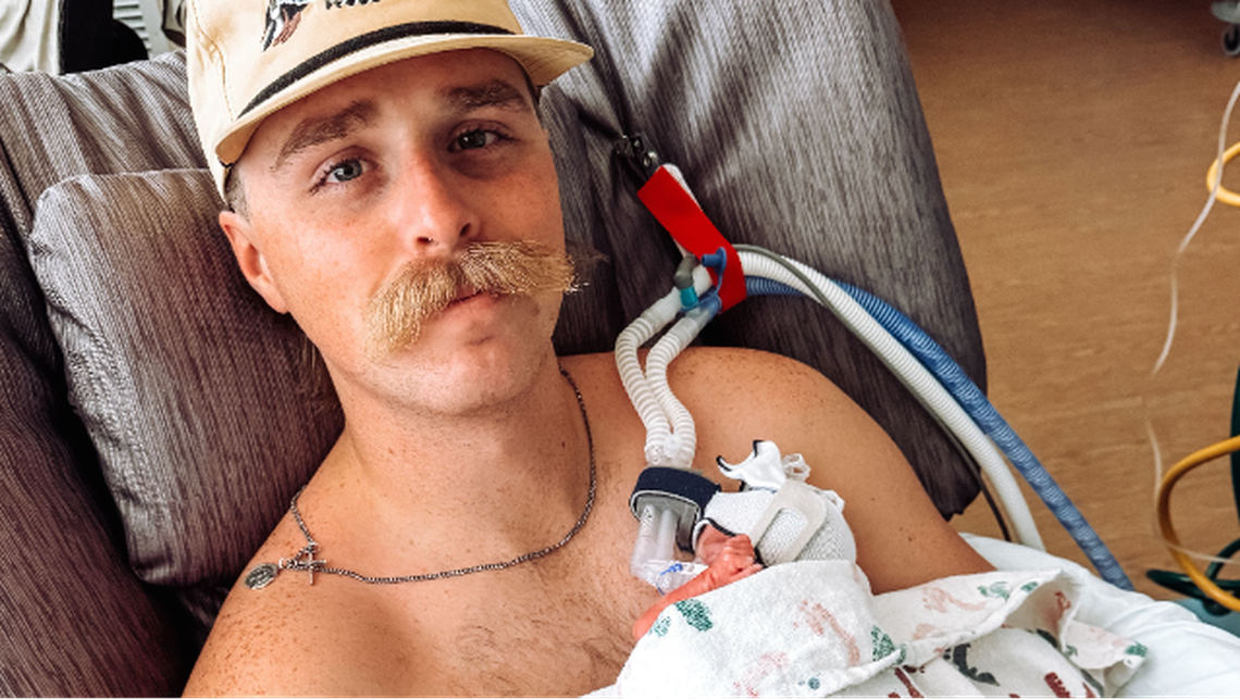 Fort Worth Firefighter Caleb Halvorson is recovering in Parkland Hospital from burns and other injuries he received when a garage collapsed on him during a house fire on Wednesday, Sept. 3. The Fort Worth Professional Firefighters Association has organized a fundraiser for his family through Help a Hero.