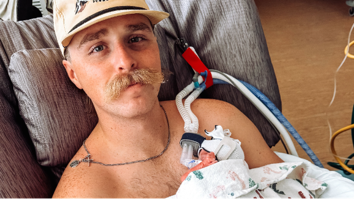 Fort Worth Firefighter Caleb Halvorson is recovering in Parkland Hospital from burns and other injuries he received when a garage collapsed on him during a house fire on Wednesday, Sept. 3. The Fort Worth Professional Firefighters Association has organized a fundraiser for his family through Help a Hero.