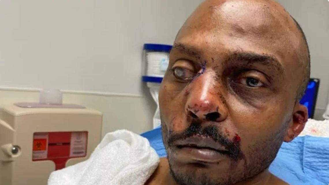 Terrance Marshall was seriously injured when he was attacked by dogs at the Arlington apartment complex where he lives.