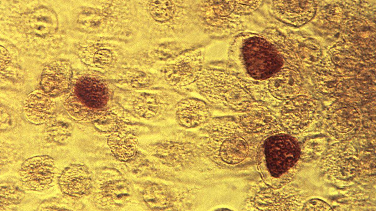 This 1975 file microscope image made available by the the Centers for Disease Control and Prevention shows chlamydia trachomatis bacteria magnified 200 times. Sexually transmitted infections are continuing to climb in Texas and throughout the U.S., according to new surveillance data released by the federal government this month.