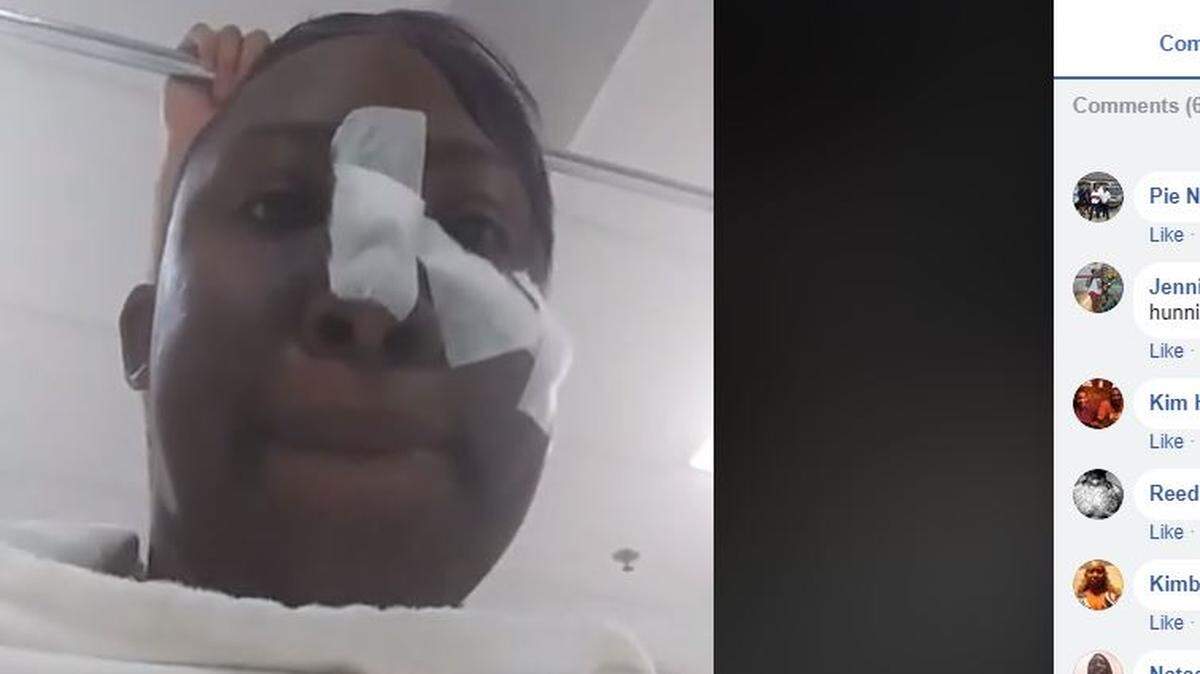 Andrea Warren was shot in the face Thursday morning during a home invasion in the 3200 block of New York Ave.