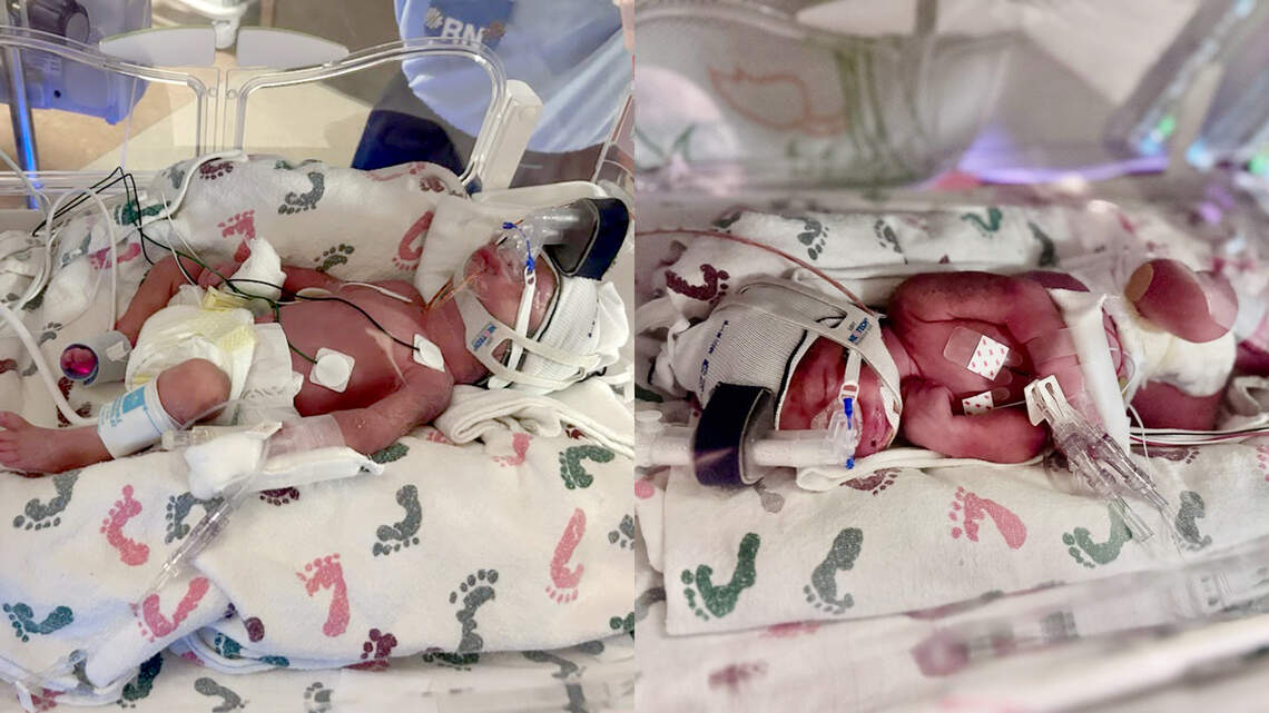 Two identical twin boys named William and Elliot arrived two minutes apart in Grapevine on Near Year’s Day at Baylor Scott White Medical Center. Two identical twin boys named William and Elliot arrived two minutes apart in Grapevine on Near Year’s Day at Baylor Scott White Medical Center.