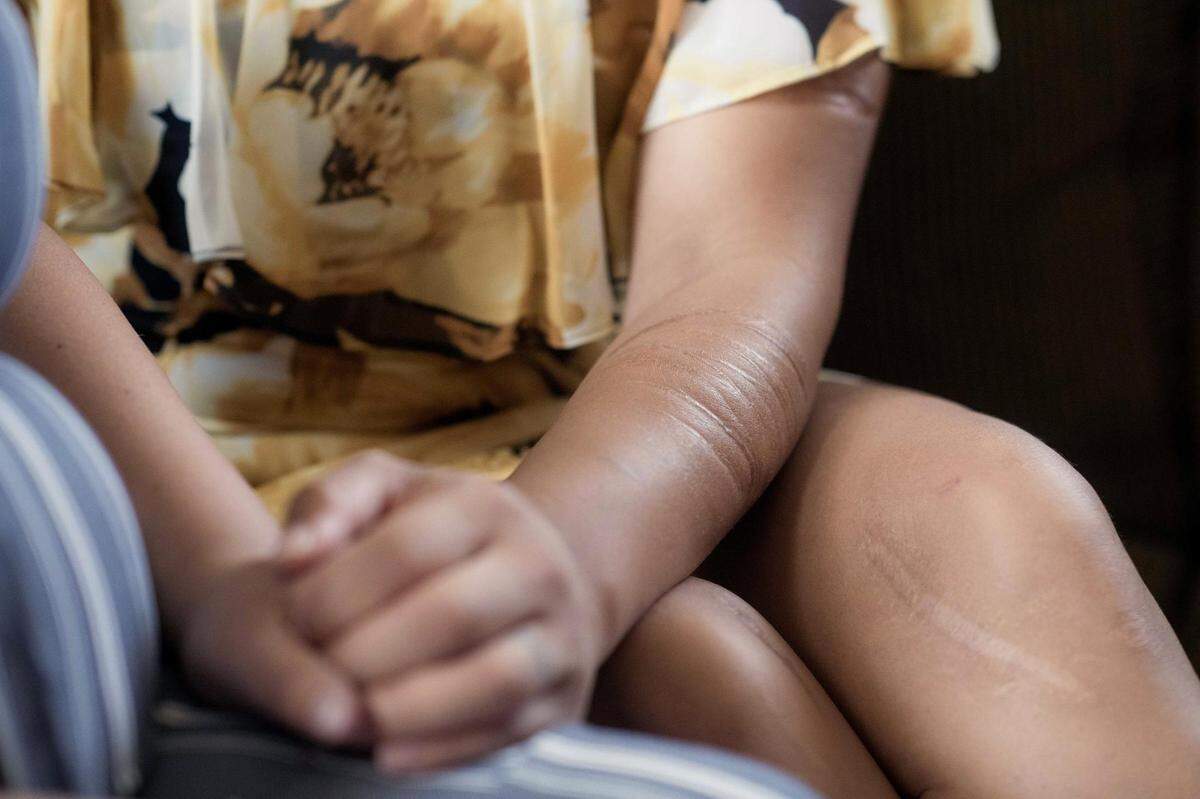 Chantel Dudley holds her sister Stephanie McGee’s hand while at home in Kingsport, Tennessee. Dudley was moved into FMC Carswell’s mental health unit after self-harming herself in 2016 when she was taken off her medication. Soon afterward, she was sexually assaulted by her case manager.