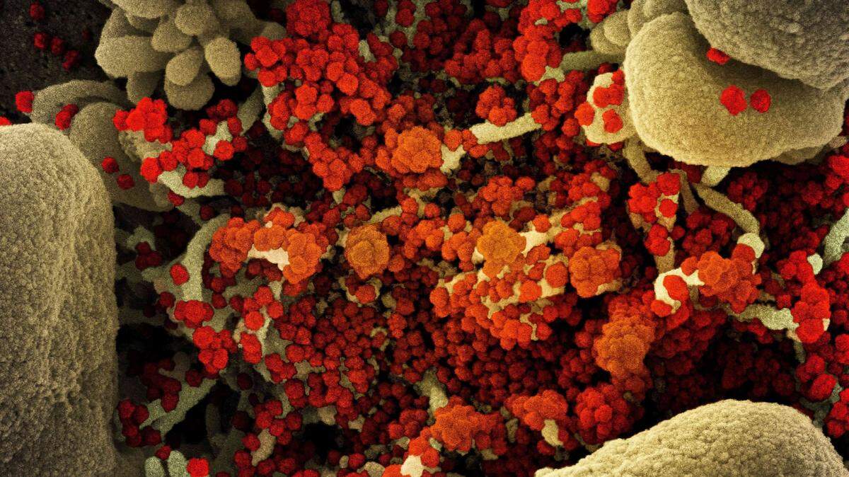 Colorized scanning electron micrograph of a cell heavily infected with COVID-19 virus particles (orange/red), isolated from a patient sample. The image was captured at the NIAID Integrated Research Facility (IRF).