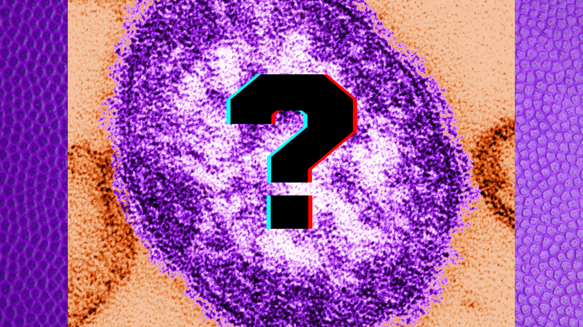 Measles is spreading in Texas. What questions do you have about the virus outbreak?