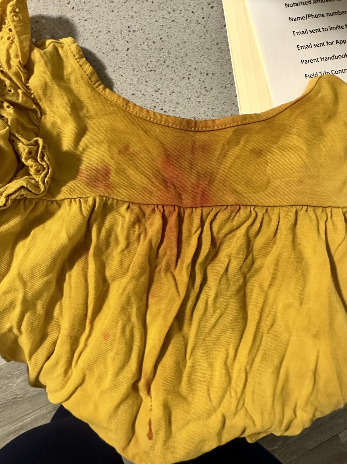 The blood-stained shirt of Hailey Scott’s and Christopher Mirzaie’s toddler daughter is shown. The North Texas family alleges in a lawsuit against The Learning Experience — Castle Hills that their daughter fell and ultimately lost one of her front teeth on a slippery floor at the child care center in Lewisville. The family says the blood from her mouth stained her clothes as a result of the incident.