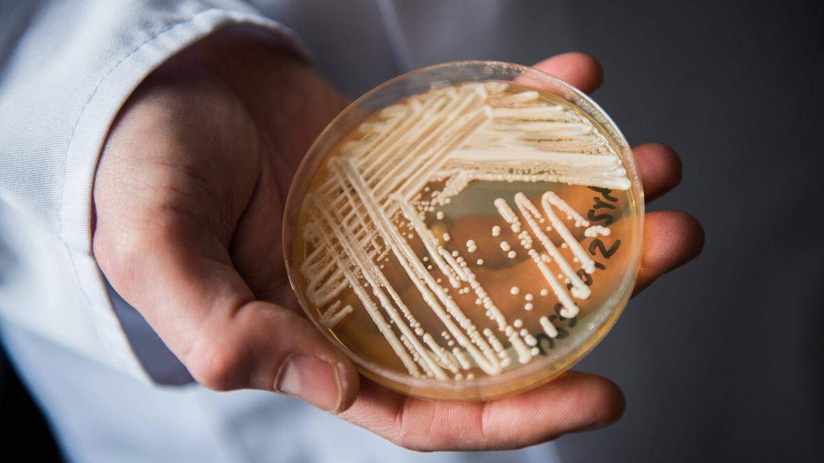 The yeast candida auris can cause serious blood infections and is difficult to diagnose and treat.