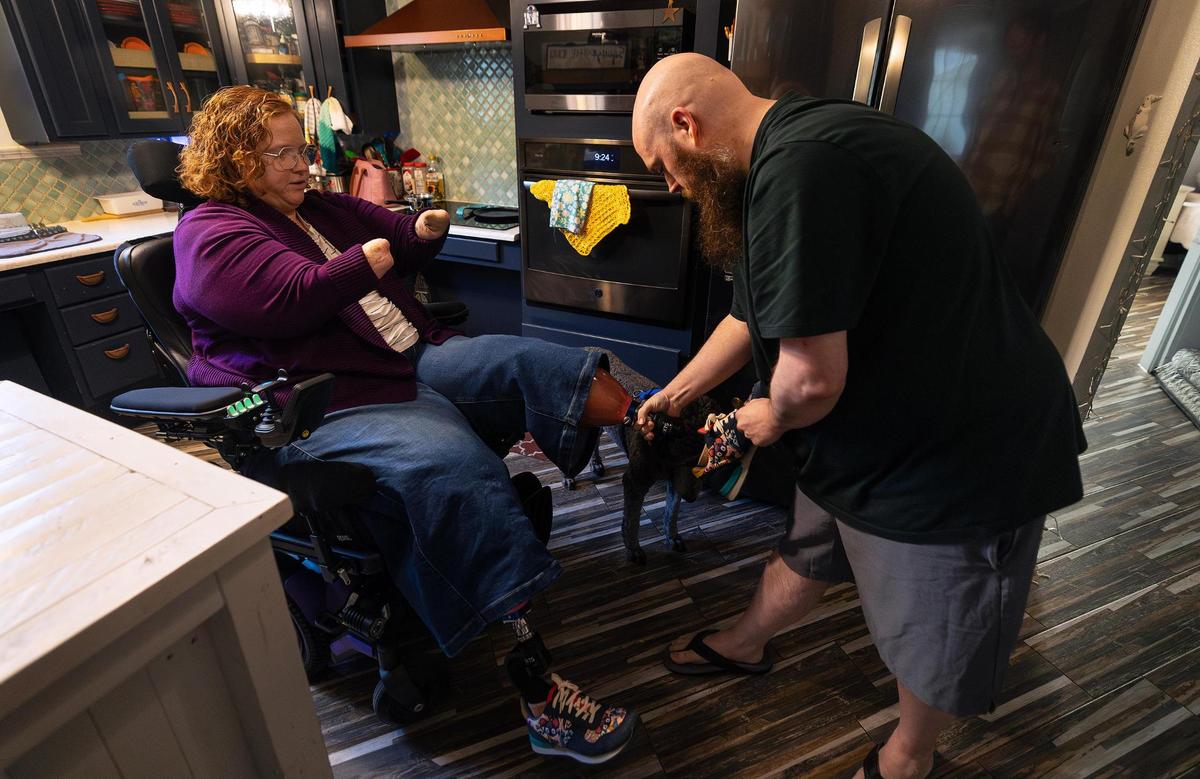 Melissa Dossey’s brother-in-law Matt Junge helps her put on her prosthetic legs while at home on Wednesday, April 9, 2025, in North Richland Hills. Junge is Dossey's full-time caretaker.