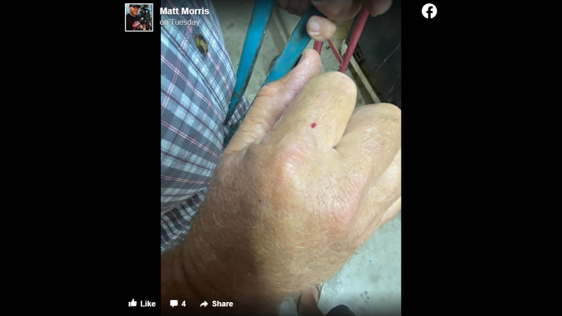 While a snake’s teeth are small, they have the potential to deliver large doses of venom.