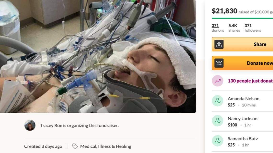 Lightning hits teen in chest on Florida beach, then shoots out his foot, family says