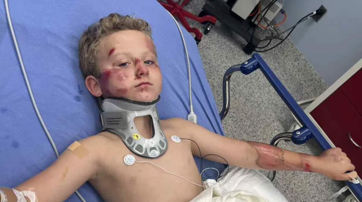An 8-year-old boy was injured in a hit-and-run while riding his bicycle outside a Fort Worth apartment complex on Friday, Sept. 5, police said.