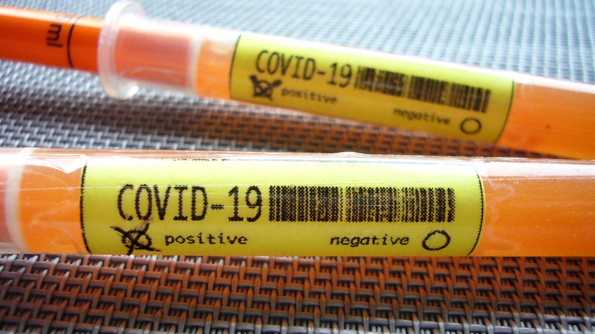 Tarrant County reported nine COVID-19 deaths and 408 new cases on Tuesday.