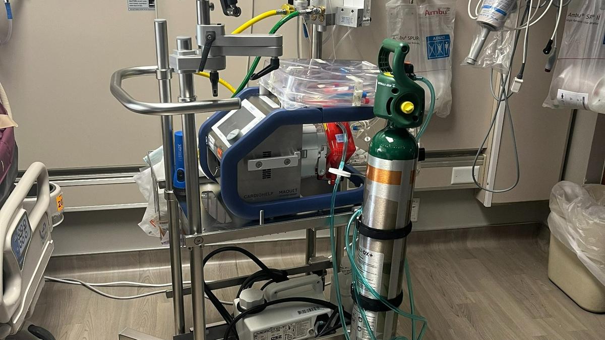 An ECMO machine at Baylor Scott & White All Saints Medical in Fort Worth. The hospital is starting to use ECMO on patients after sudden cardiac arrest, an intervention that could dramatically increase a patient’s chance of surviving and recovery.