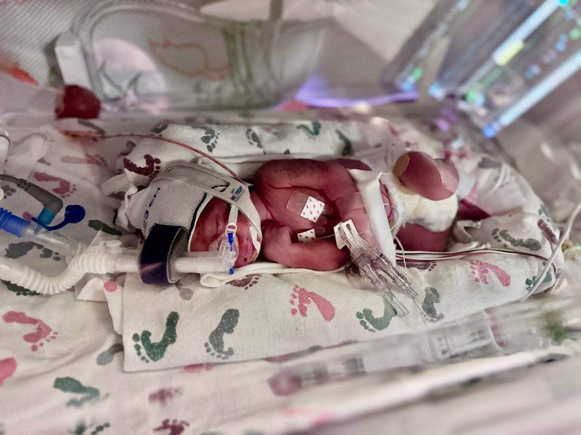 The twins were delivered by C-section ahead of their due date and will remain in the NICU for at least a few weeks.