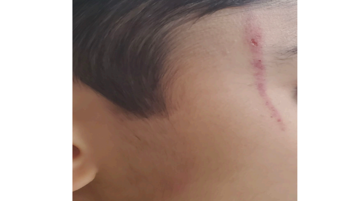 A lawsuit in Tarrant County alleges these injuries were caused to a 7-year-old boy with non-verbal autism after he was thrown against a wall at ABA Interactive in North Richland Hills.