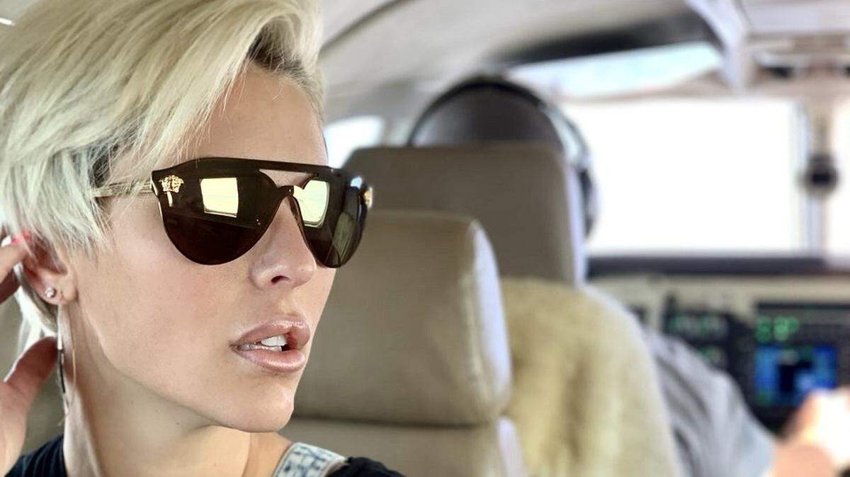 Lauren Johnson overcame hair loss and a serious health disorder before committing to help others cope with similar issues.