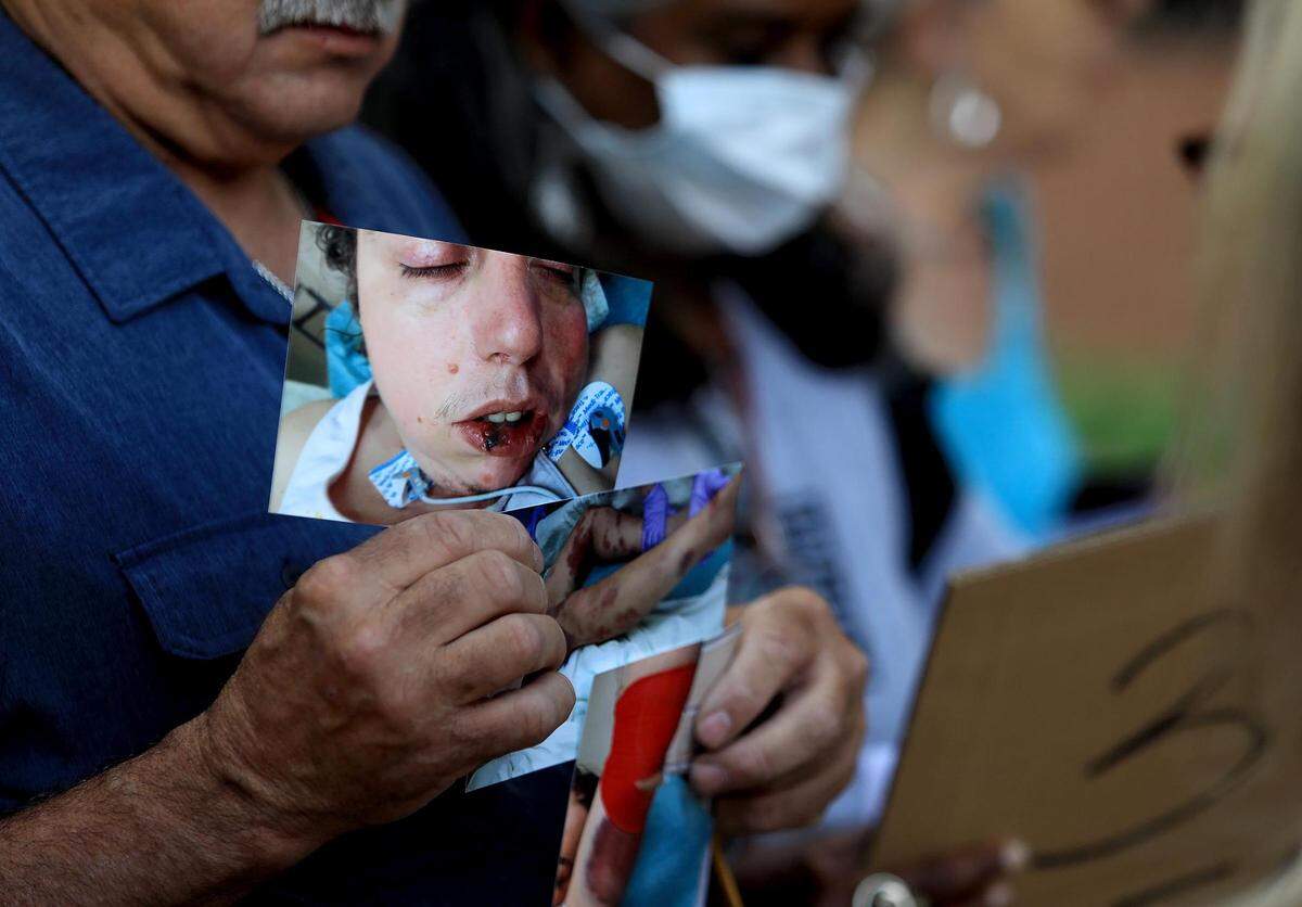 Danny Masten holds photographs of his daughter, Kelly Masten, which were taken after a 10 day stay in the Tarrant County Jail. Kelly Masten, who has nearly daily seizures and the mentality of a 6-year-old, is still in a coma at John Peter Smith Hospital. Danny Masten was just one of many who were rallying outside the Tarrant County Court of Commissioners meeting on Tuesday, May 10, 2022, to demand changes at Tarrant County’s jails.