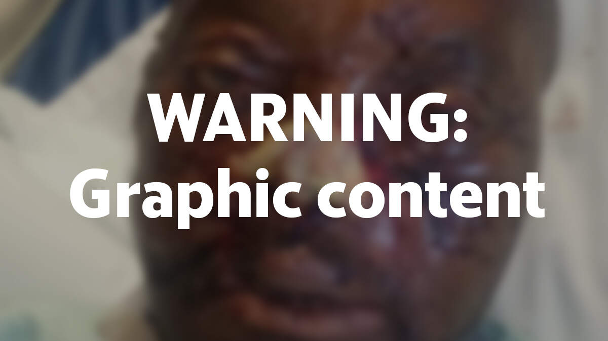 WARNING: GRAPHIC CONTENT. Several images in this story may be inappropriate for some viewers.