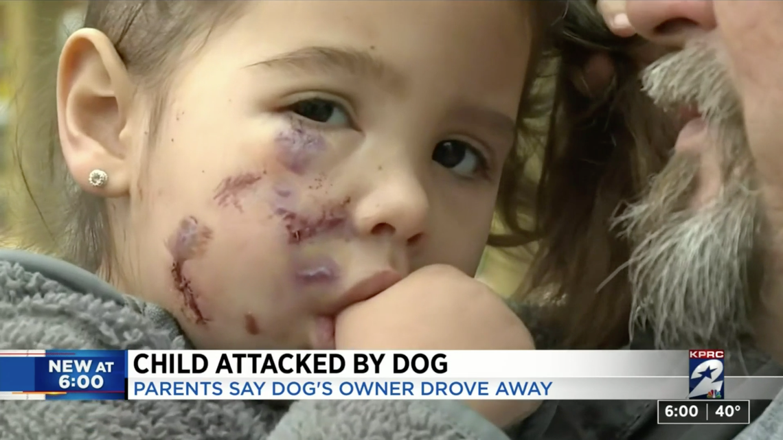 Ronin Waldroup, 3, was attacked by a dog at a restaurant in Spring, Texas, her family says. She received several stitches after the incident.
