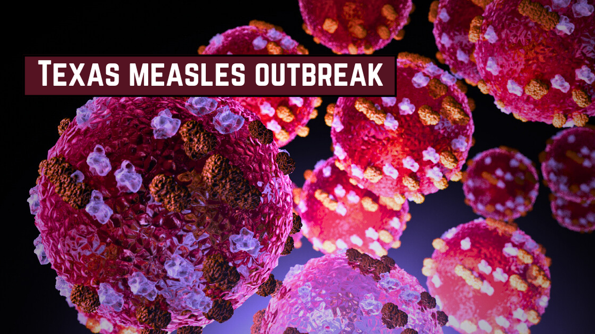 U.S. measles cases at highest in 33 years, CDC says. Here’s how many are in Texas