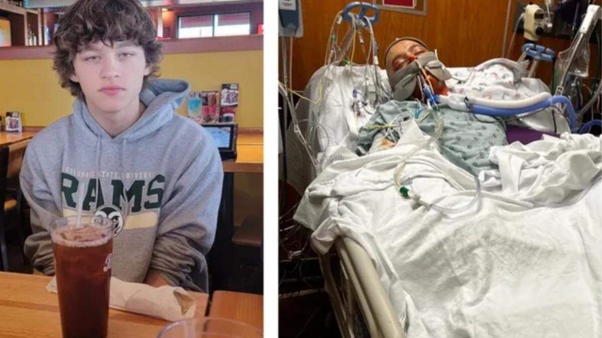 Jaiden Glover, 17, was severely burned on more than 60% of his body when he ran into a Saginaw power station while experiencing a mental health crisis, his family said. He died at Parkland Hospital in Dallas.