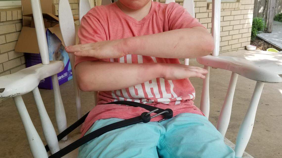 The parents of a 10-year-old student with autism said his rights were violated when a Denton school called police to address behavioral issues.  He is shown in this picture with bruises believed to be sustained when police restrained him with handcuffs.