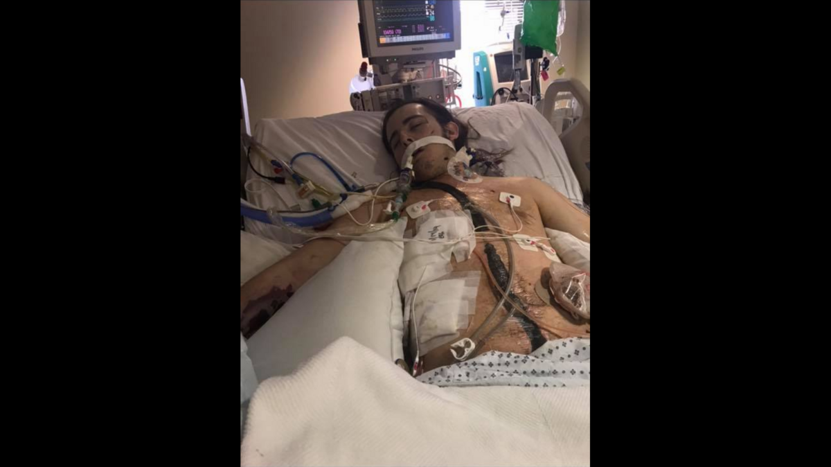 Six months and over a dozen surgeries after Oklahoma City resident Brett Duncan, 20, was shot during a home invasion robbery, he was just starting to recover. Now someone stole his wheelchair, his family says. Photo from Kimberlee Duncan