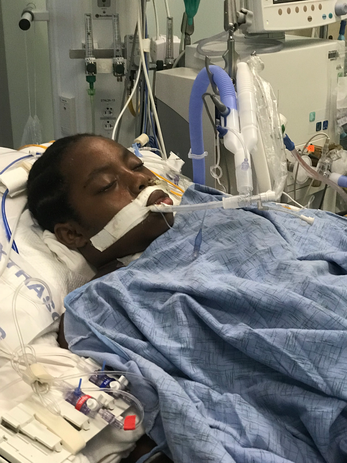 A girl who was waiting for a bus to school was brutally attacked on April 19 and hovers between life and death while awaiting a new heart for a transplant operation.