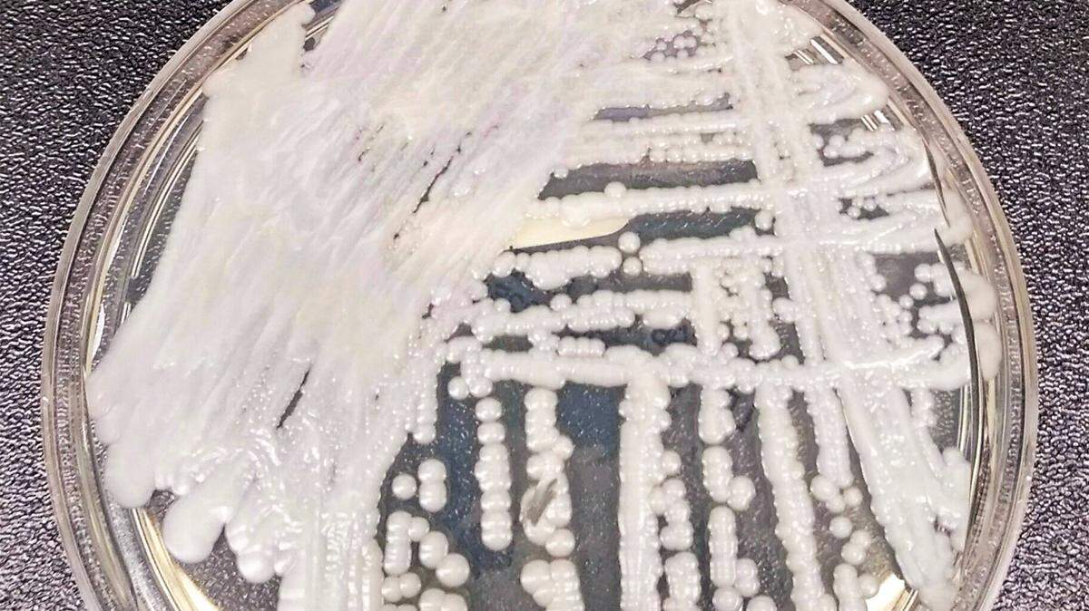 Candida auris, seen here in a Petri dish culture plate, is a drug-resistant fungus that’s been increasingly reported in Illinois.
