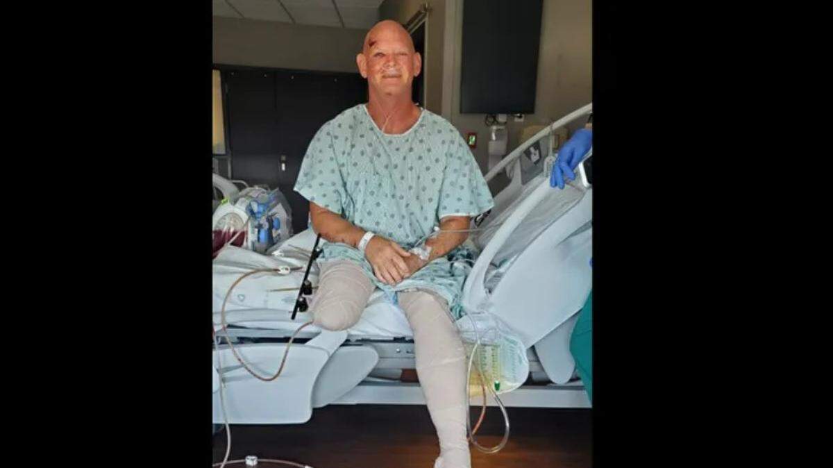 Officer Joe Lock was critically injured and remains hospitalized after he was dragged by a car outside a federal office in Fort Worth on July 18, according to his family’s account on a GoFundMe page.