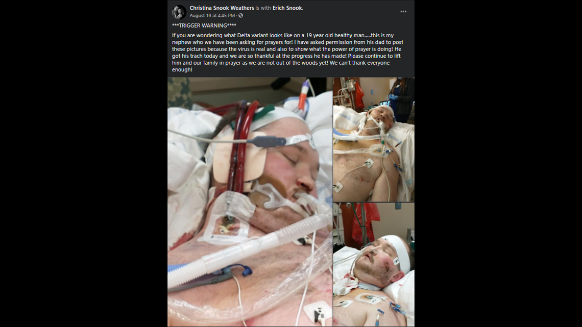 Aunt Christina Snook Weathers shared these photos of her 19-year-old nephew, Ethan Snook, to show what COVID-19’s Delta variant can look like on a “healthy man.”