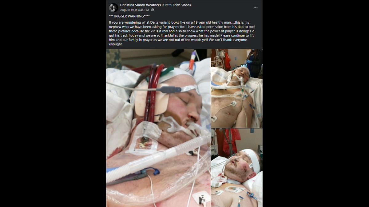 Aunt Christina Snook Weathers shared these photos of her 19-year-old nephew, Ethan Snook, to show what COVID-19’s Delta variant can look like on a “healthy man.”