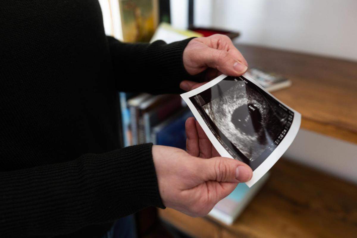 Kara Gardeen hold an ultrasound photo of a baby she miscarried Feb. 18, 2022, in Keller. Gardeen was confronted about payment while in the exam room amid the miscarriage at Texas Health Alliance, something she wanted to see changed.