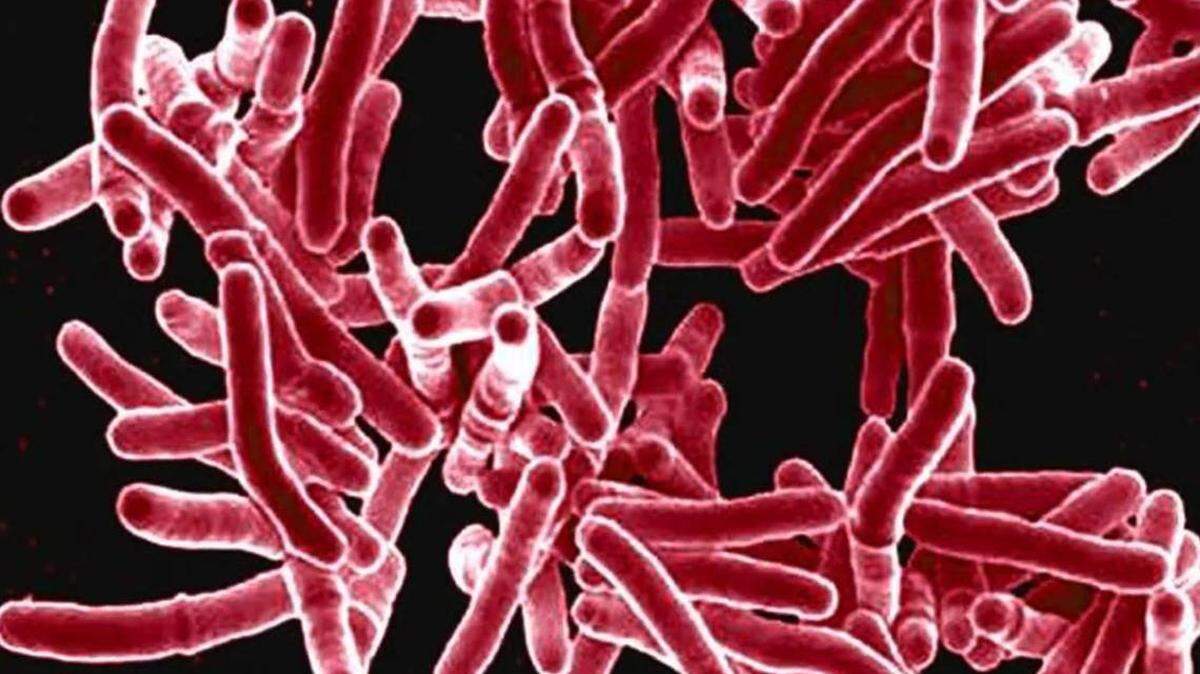 Tuberculosis is the world’s deadliest disease and has claimed at least two lives during a current breakout in the greater Kansas City area.