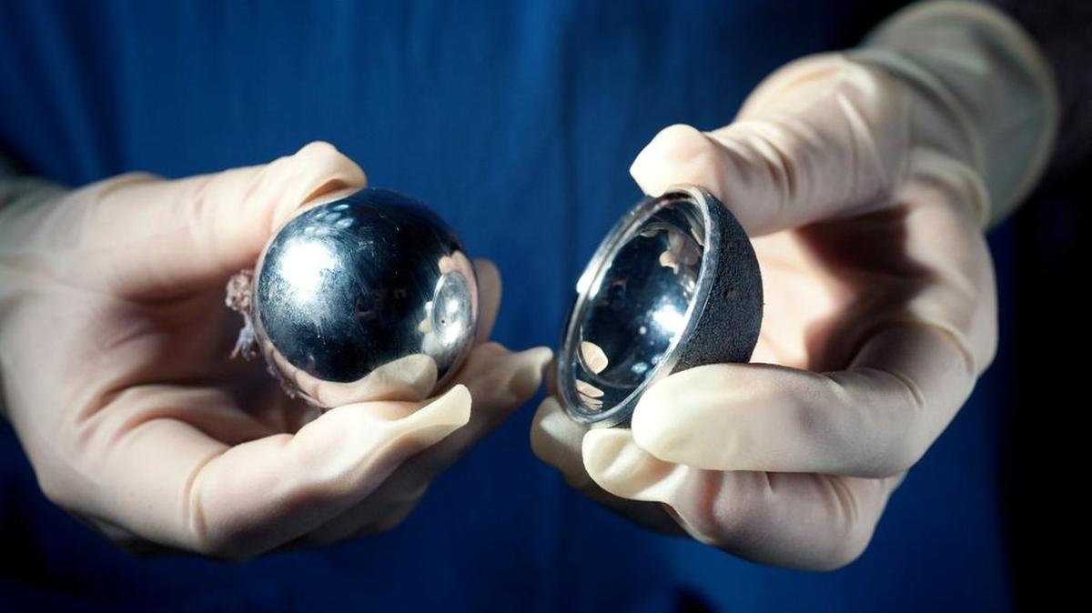 A faulty DePuy artificial hip removed from a patient in Hartlepool, England, in 2010. A federal jury in Dallas found that officials of Johnson & Johnson and its DePuy unit failed to properly warn doctors and patients about the product’s flaws.