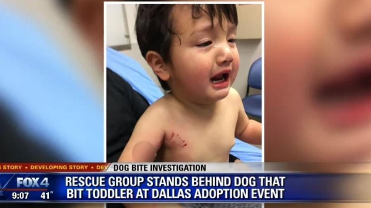 Luca Romero, 2, after being bitten at a dog adoption event in Dallas.