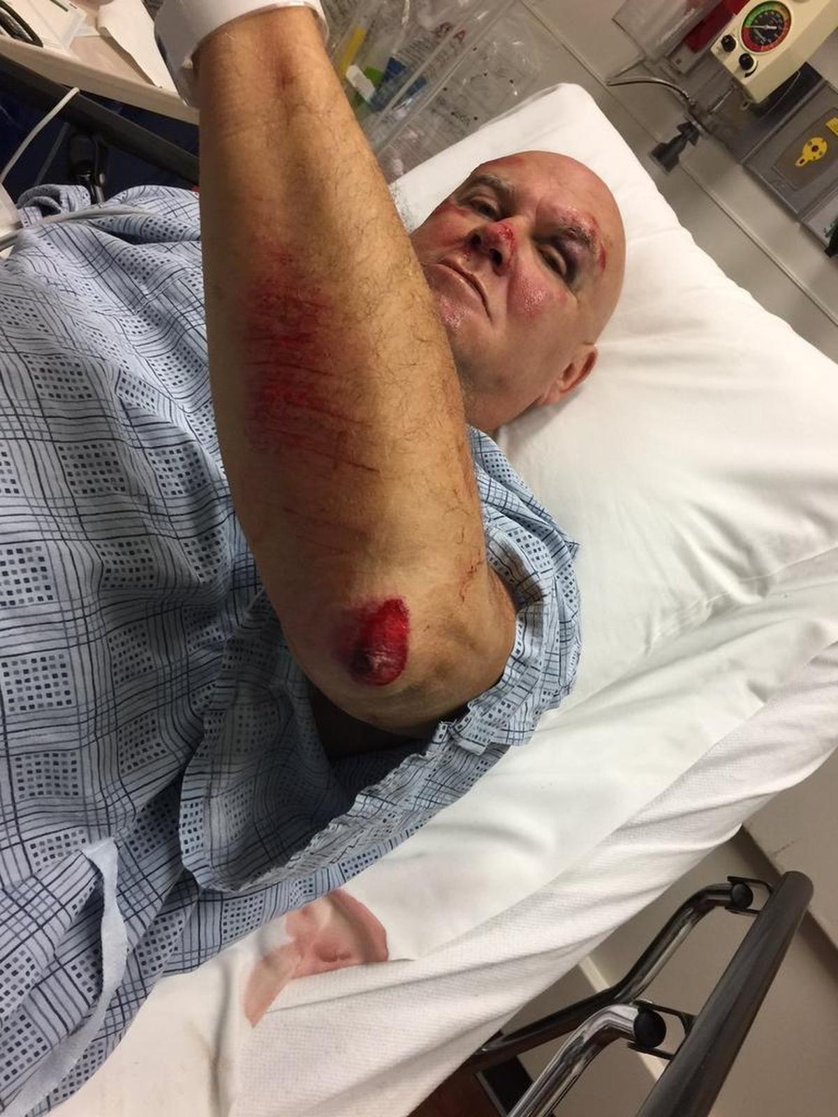 Skip Pepe was taking his daily walk in Cravens Park on May 25 when he was attacked and robbed.
