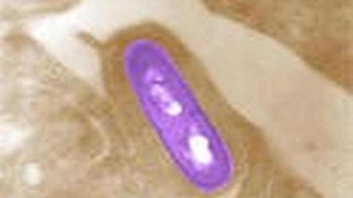 Listeria monocytogenes can cause listeriosis, a serious infection that primarily affects older adults, persons with weakened immune systems and pregnant women and their newborns.