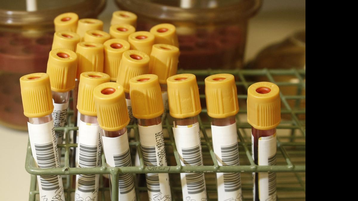 
The lab technician in question processed blood samples from DWI cases in Tarrant County.
