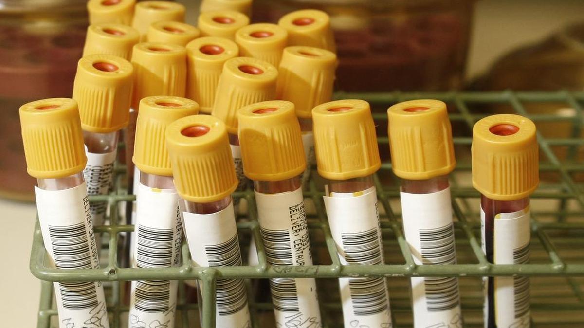 
Tarrant County law enforcement officers will be ready to compel suspected drunken drivers to submit to blood tests during the Memorial Day holiday weekend.
