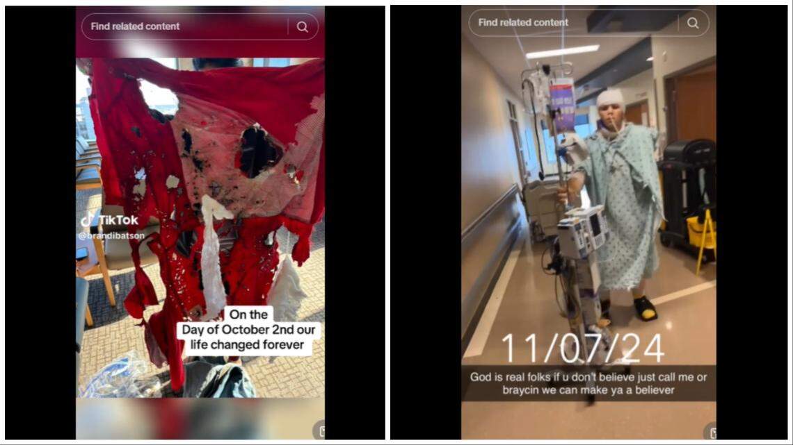Braycin Parrish’s tattered clothes (left) after the accident, and Parrish walking at a hospital where he’s been recovering for weeks.