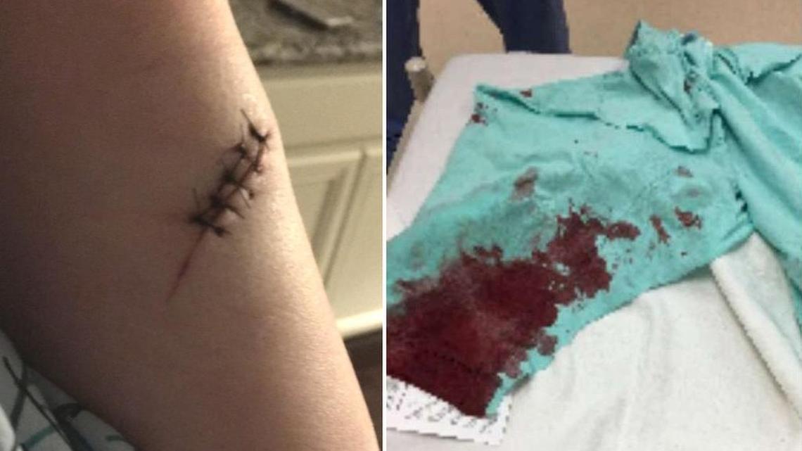 An Islamic nurse was stabbed in the arm early Thursday morning in Houston after a white man shouted slurs at her.