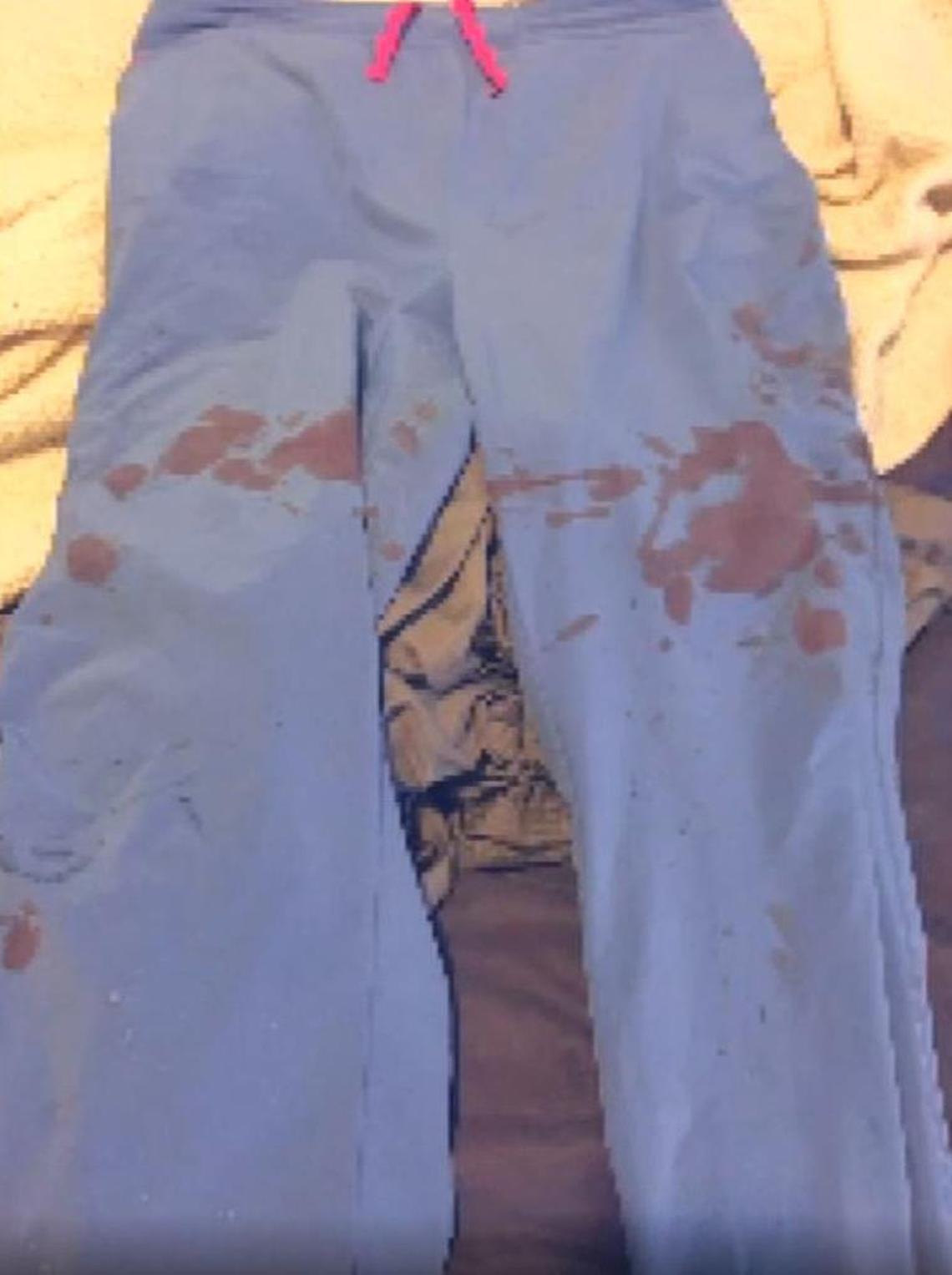The nurse’s scrubs were dotted with blood after she was stabbed in the arm.